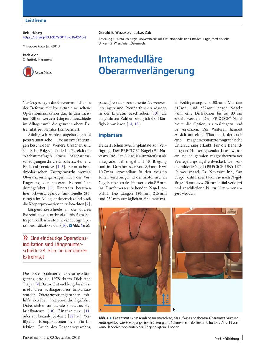  INTRAMEDULLÄRE OBERARMVERLÄNGERUNG