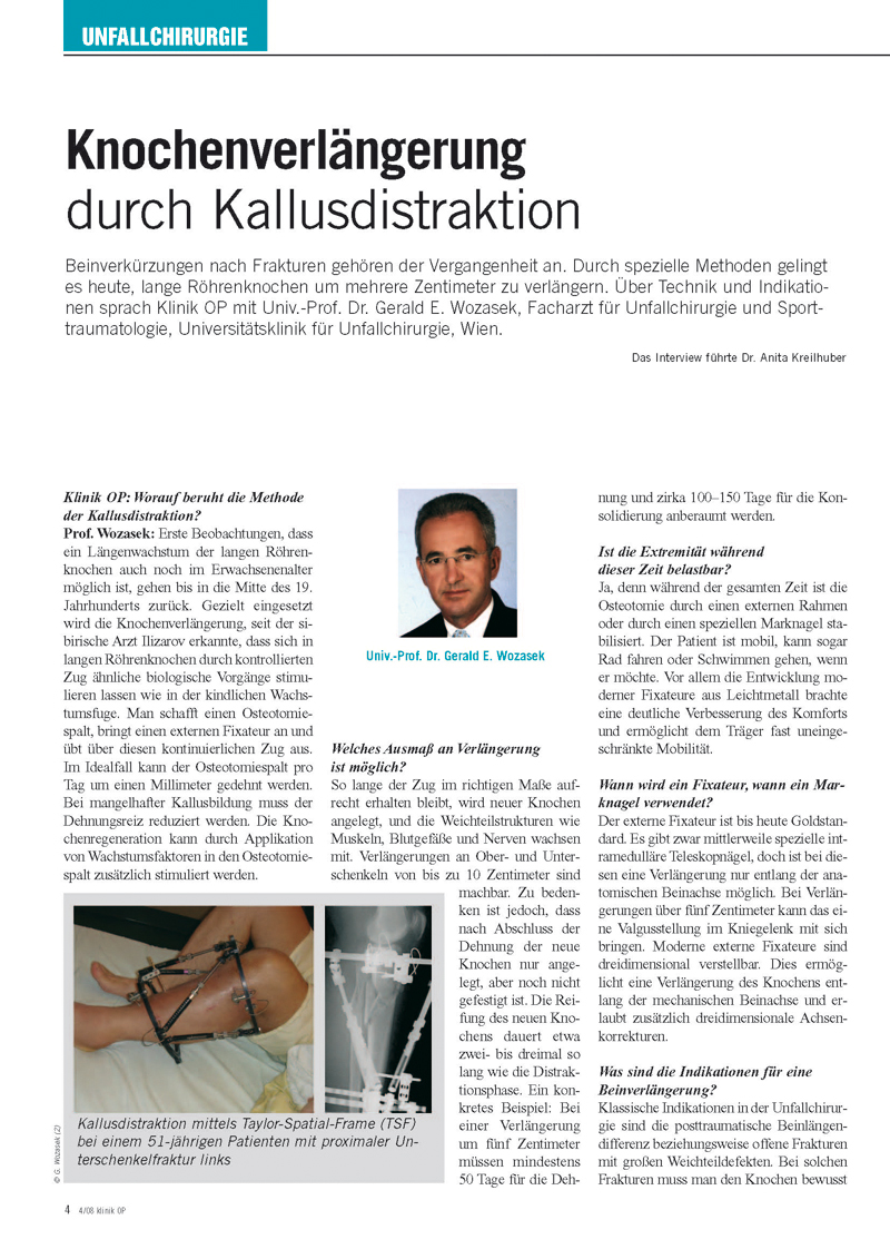 Knochenverlängerung durch Kallusdistraktion