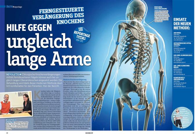 Knochenverlängerung