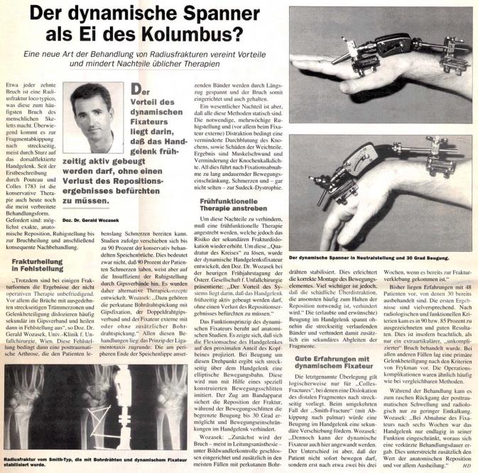 Der dynamische Spanner als Ei des Kolumbus?