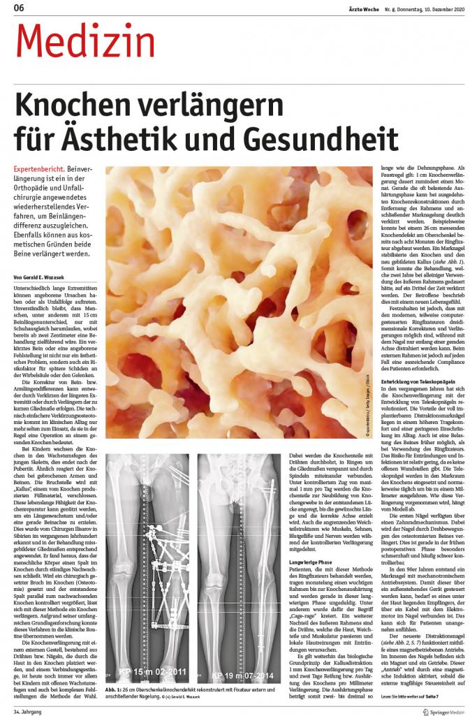 Knochen verlängern für Ästhetik und Gesundheit